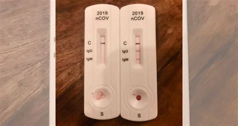 These tests can also be useful in screening efforts. NTT man's COVID-19 test shows 'reactive' result for ...