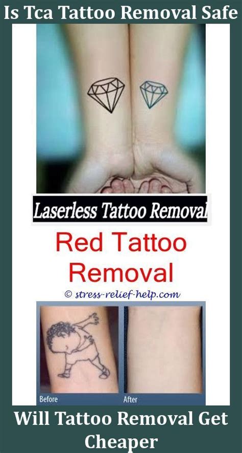 Use peroxide, mouthwash, nail polish remover or even clean water to break apart the temporary tattoo. Where Can I Get A Tattoo Removed Free Tattoo Removal Los ...