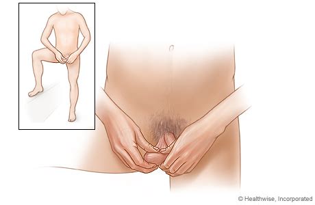 New videos added every day! Testicular Self-Examination (TSE) | UW Health | Madison, WI