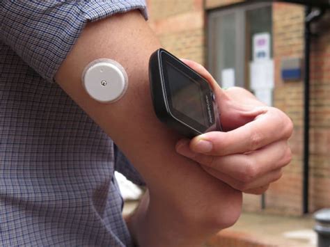Flash device to launch but people with type 1 diabetes in ...