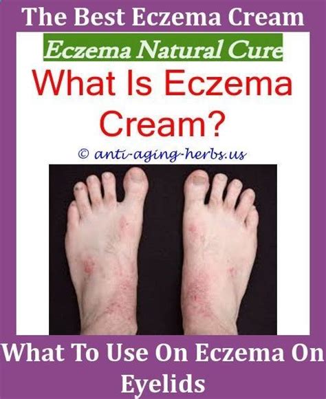 There are many different preparations for each type of medicine and it's worth taking time with a pharmacist or gp to find the best one for you. Hazelwood For Eczema,emollient for eczema emollient eczema ...