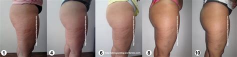 Mit die beste methode, cellulite ohne jegliche hilfsmittel den krieg zu erklären, ist sport (z.b. Beine Slimspec´s Blog von Cellulite Behandlung Zu Hause ...