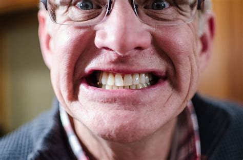 Straighten teeth without braces can be fun for everyone. How to Straighten Teeth Without Braces? - North DeKalb ...