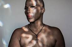 flat breast cancer after topless going summer york paulette leaphart patients