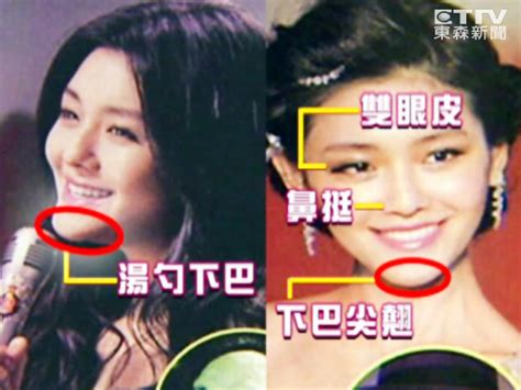 Jun 07, 2021 · 至於和女星張雨綺的舊情，汪小菲表示那是一段「痛苦並快樂著」的回憶，因為性格爆炸的張雨綺只要遇到不如意的事就會發飆甚至動手，而汪小菲. 大S談整形熱潮成撞臉歪風 網友點名汪小菲舊愛張雨綺 | 娛樂星光雲 | ETtoday東森新聞雲