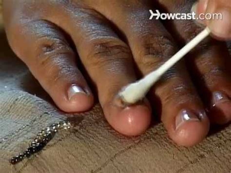As the nail grows gradually, it will probably push out the remaining splinter. How can you get rid of nail fungus naturally? There are a ...