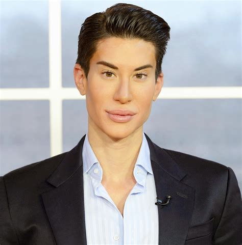 Human Ken Doll Before Surgeries – Telegraph