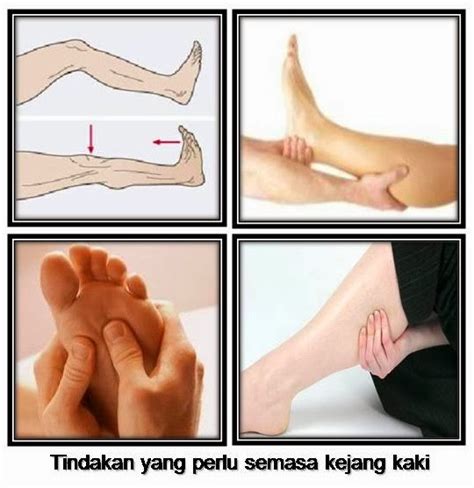 Kesan daripada pengambilan botox termasuk rasa sakit dan lemah otot yang. Apa Yang Anda Perlu Lakukan Jika Tiba-Tiba Kena Simpul ...