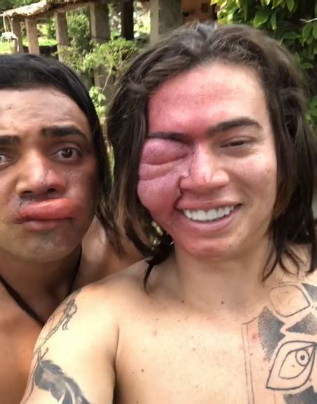 O youtuber whindersson nunes acabou assustando os seus seguidores no instagram, ao exibir uma foto sua junto com tirullipa, onde eles aparecem com o rosto deformado. Whindersson Nunes aparece com rosto deformado e assusta ...