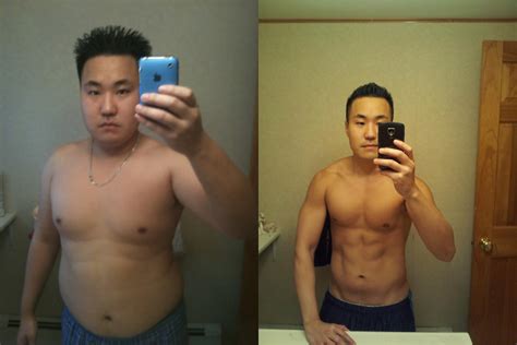 Quick weight loss diet before surgery, reddit losing ...