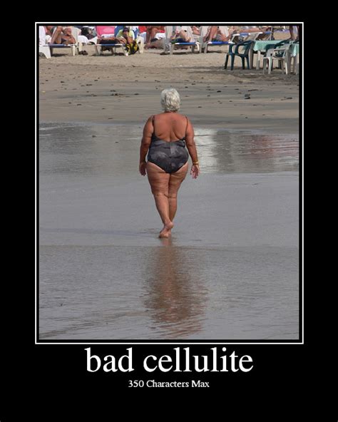 'dimples on my legs don't dictate my life': bad cellulite - Picture | eBaum's World