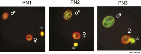 Is the zygote stage unicellular. File:Zygote pronuclei stages 01.jpg - Embryology