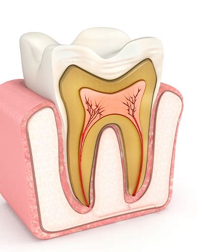 It can also relieve pain that you felt in your tooth because it was infected. Greenwood Restorative Dentistry | Greenwood Springs Family ...