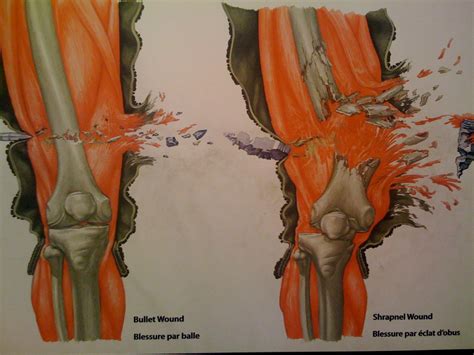 Get your up to date 50 cal paintball gun and you will begin to see all of the new 50. bullet wound vs. shrapnel | Art | Pinterest | Bullets