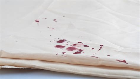 Once completely dry, scrape the residue off, and dab at any remaining stain with a white rag dipped in hydrogen peroxide. How To Remove Blood Stains | The Ladies Room