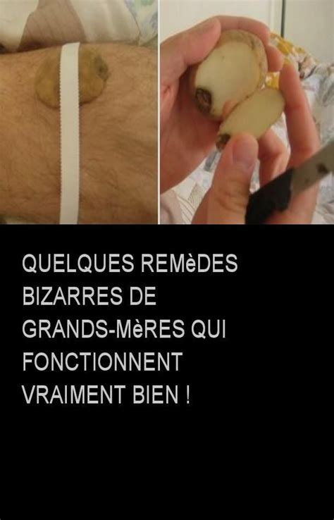 Épinglé sur Astuce Santé