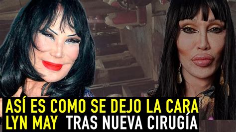 Lyn may deja ver su cara de cuando estaba joven y causa sorpresa. Así es como se dejó la cara Lyn May tras nueva cirugía ...