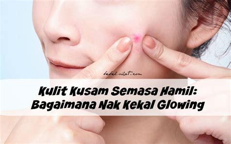 Anda mengalami masalah rambut gugur semasa hamil yang teruk? Kulit Kusam Semasa Hamil: Bagaimana Nak Kekal Glowing ...