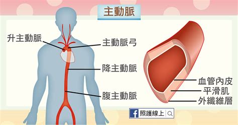 56829 12 3 4 5 6 7 8 9 10. 致命的炸彈 - 主動脈瘤（懶人包） - 照護線上