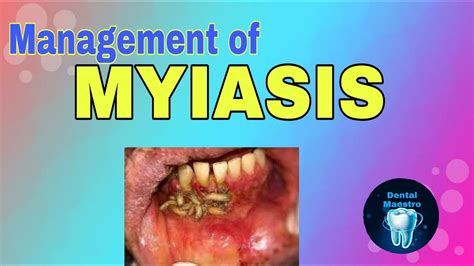 Myiasis is the parasitic infestation of the body of a live animal by fly larvae (maggots) which grow inside the host while feeding on its tissue. MYIASIS | Infection from flies | Management | dental ...