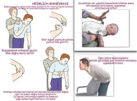 Heimlich manevrası olarak adlandırılan ve solunum yolunun yemek ya da yabancı bir cisimle tıkanması sonucu boğulmayı engellemek için kullanılan tekniktir. Heimlich Manevrası Nedir? Yetişkin, Bebek ve Kendi Başına ...