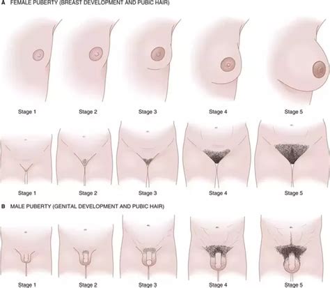 In some girls (about 15%), pubic hair may be the first sign of puberty―showing up before breast budding starts. How to get my tanner stage without going to the doctor - Quora