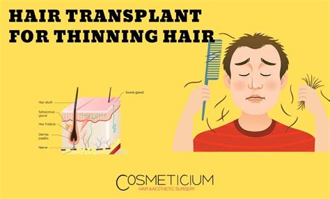 Hair Transplantation for Thinning Hair: What is the ...