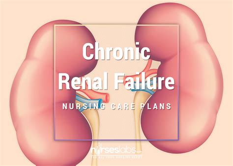 These sections of the chapter review the main classication systems and causes of renal disease. 17 Chronic Renal Failure Nursing Care Plans | Nursing care ...