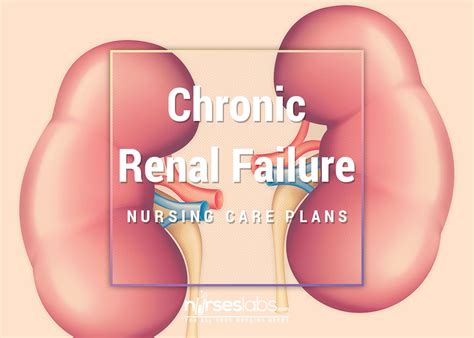 Associated documents • chronic kidney disease flow sheet. 17 Chronic Renal Failure Nursing Care Plans | Nursing care ...