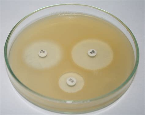 Aug 27, 2018 · mueller and hinton developed mueller hinton agar (mha) in 1941 for the isolation of pathogenic neisseria species. Dehydrated Culture Media Exporter,Dehydrated Culture Media ...