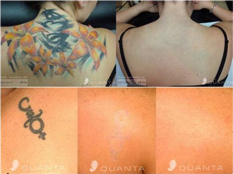 Enter a different phone number. Gallery | Fresno, CA | California Vein & Laser