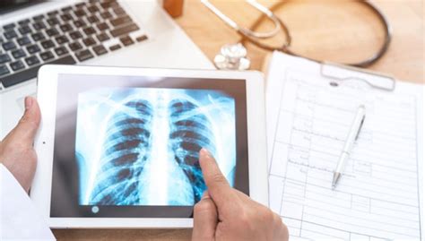 Proposals for revisions of the t descriptors in the forthcoming eighth edition of the tnm classification for pleural mesothelioma. The Significance of TNM Staging in Mesothelioma Diagnosis ...