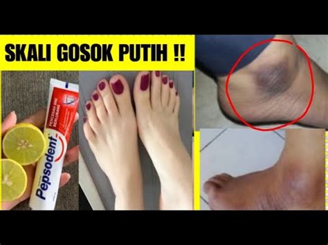 5 bercahaya tajam (tt mata ketika sedang. 5 MENIT AJA MATA KAKI HITAM KASAR JADI PUTIH BERSIH ...