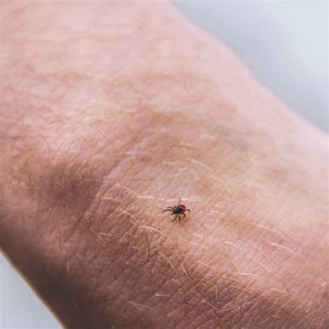 Trombiculidae are a family of mites. Nail Polish Treatment For Chiggers - Nail Ftempo