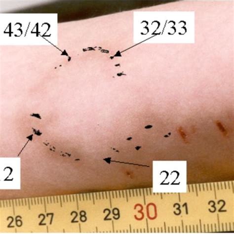 Antonio rudiger appears to have taken a page out of luis suarez's book as it looks like he bites paul pogba's shoulder during germany's euro 2020 match vs. a: Negative impressions of the bite mark taken from the apple | Download Scientific Diagram