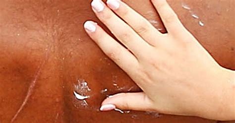 Rheumatoid arthritis is a type of autoimmune disease. Wonder drug that cures eczema, arthritis AND hair loss ...