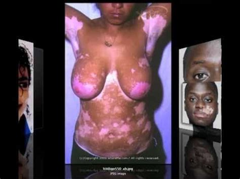 Keep aside and let the mixture cool down for a few minutes, then apply the mixture on your hairs gently with the help of your hands or a brush. Black People Who Turn Into White People Naturally pt 2 ...
