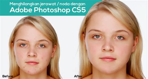 Cara menghilangkan bekas jerawat hitam di pipi secara alami dapat menggunakan air lemon hingga lidah buaya. tutorial photoshop - cara menghilangkan jerawat/noda ...