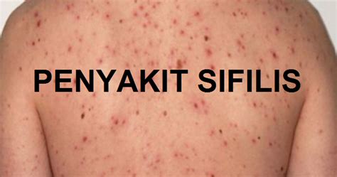 Penyakit berjangkit disebarkan oleh patogen yang dipindahkan daripada seseorang mangsa (hos) kepada mangsa yang. Kenali Penyakit Sifilis | Download Percuma