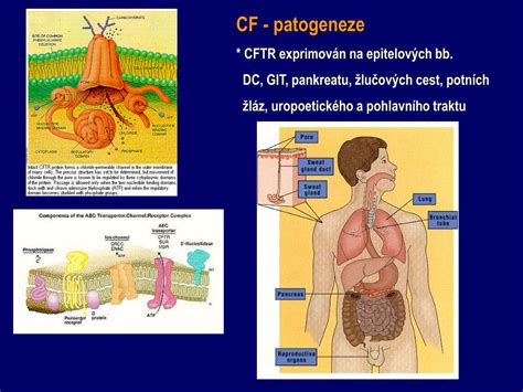 Cystická fibróza u dětí se vyvine kvůliporušení struktury sedmého chromozomu (jeho rameno). PPT - Cystická fibróza (mukoviscidóza) PowerPoint ...