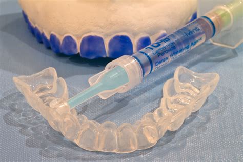 Hierbei wird ein spezielles gel auf die zähne aufgetragen, welches verfärbungen der zähne von innen heraus korrigiert. Bleaching - zahnarzt-mitrovics Webseite!