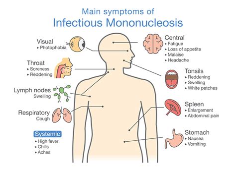 It's often spread through contact with infected saliva from the mouth. Mononucleosis: How to Recover from (and Avoid) the ...