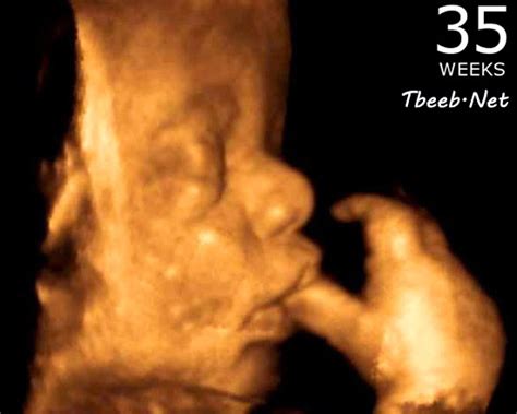 حبوب حول الحلمتين من علامات الحمل عالم حواء. الاسبوع 36 من الحمل اي شهر يكون
