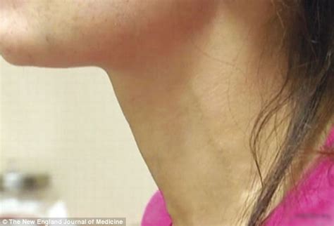 Naughty 18yr older gets penetrated and obtains a faceshot in this nonprofessional pornography. Severe pulsating neck veins led doctors to diagnose her ...