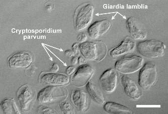 Human cryptosporidiosis is caused by infection with apicomplexan protozoans of the genus cryptosporidium. cryptosporidium parvum and giardia lamblia oocysts ...