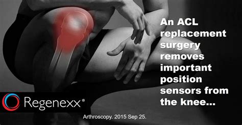 Последние твиты от acl treatment (@acltreatment). ACL Knee Surgery Options: Preserve the Stump? - Regenexx®