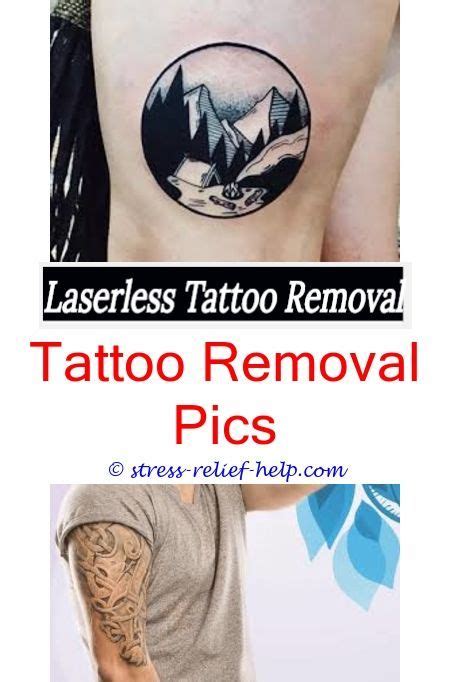 Laser methods are most popular but there are other ways to remove a tattoo as well. Do getting tattoos removed hurt.How painful is getting a ...