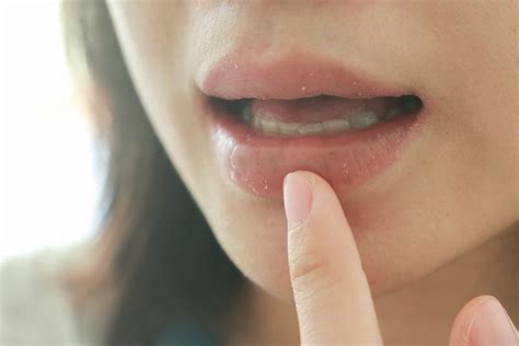 Does Diabetes Cause Metallic Taste in Mouth? - Breathe Well-Being