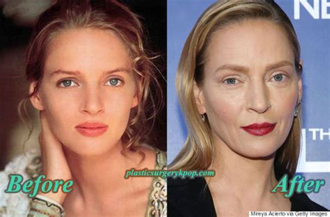 Uma Thurman Plastic Surgery Before and After Pictures uma ...