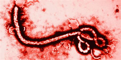 Hanya 10% penderita ebola yang selamat dari infeksi virus ini, tetapi penyakit ini jarang terjadi. Virus Ebola Dapat Bertahan Di Sperma - Warnaunyu.com ...